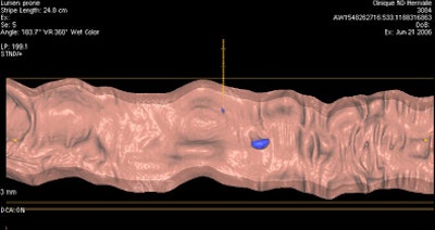 2007 12 17 12 28 17 706