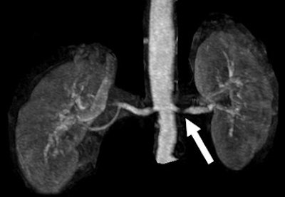 2008 01 09 13 30 00 706