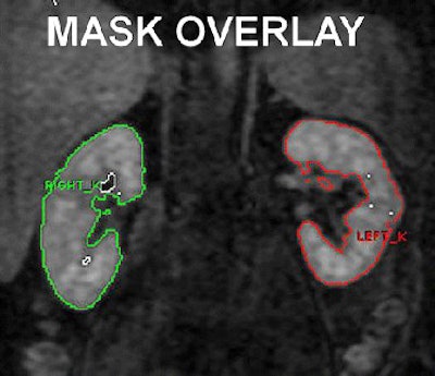 2008 01 09 13 30 17 706