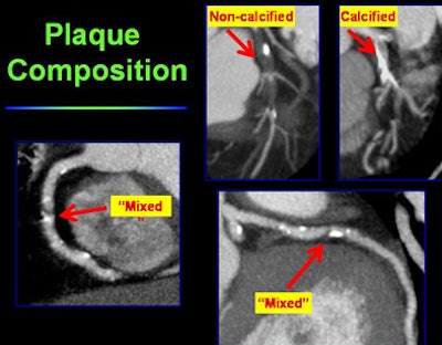 2008 01 14 15 28 22 706
