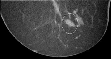 2008 01 18 16 03 03 706