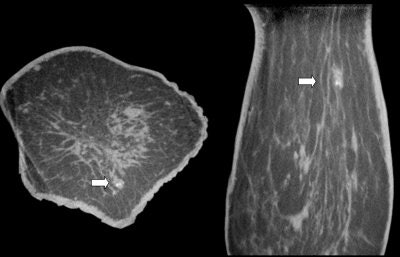 2008 01 18 16 03 41 706