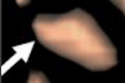 2008 01 21 15 54 33 706