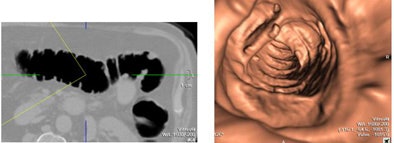 2008 01 22 11 30 38 706