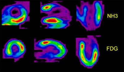 Flow-metab_mismatch.JPG (25936 bytes)