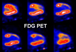 Scar Fdg