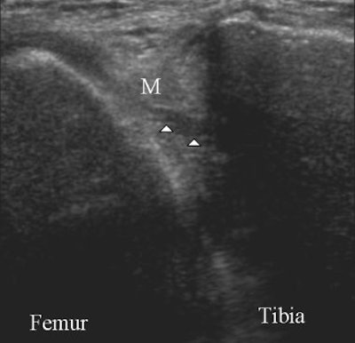 2008 02 04 16 32 35 706