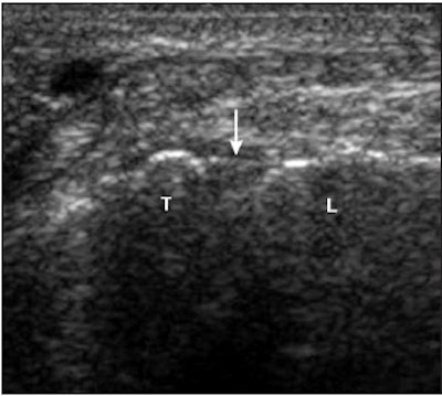 2008 02 04 17 12 18 706