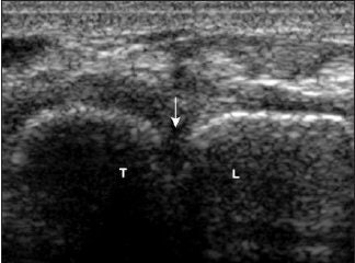 2008 02 04 17 12 29 706