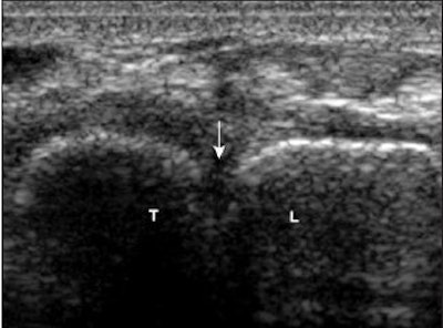 2008 02 04 17 12 29 706