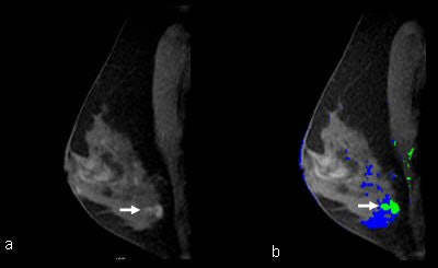 2008 02 14 11 41 02 706