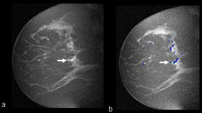 2008 02 14 11 41 17 706