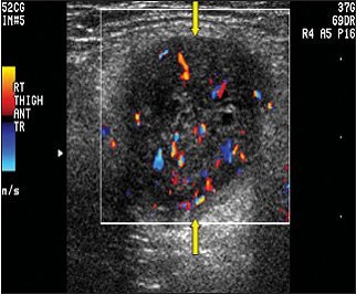 2008 02 21 17 05 42 706