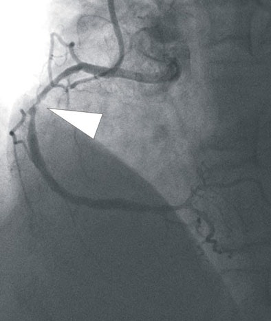 2008 03 05 17 00 23 706