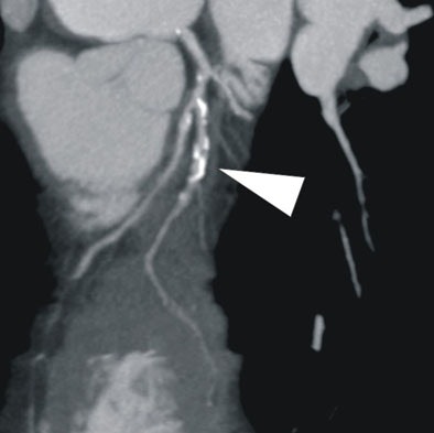 2008 03 05 17 00 49 706