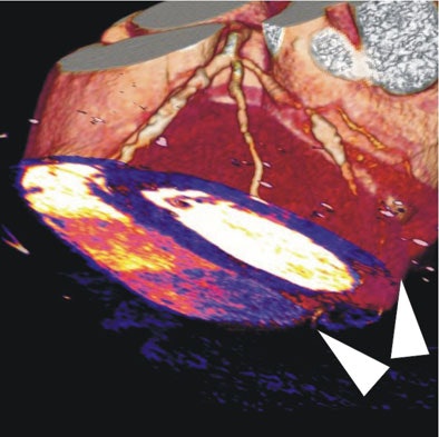 2008 03 05 17 01 03 706