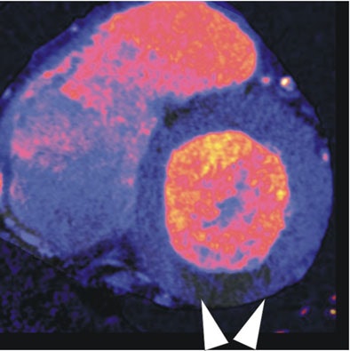 2008 03 05 17 01 15 706