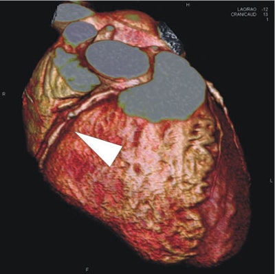 2008 03 05 17 01 30 706