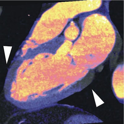 2008 03 05 17 01 57 706