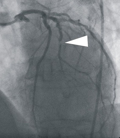 2008 03 05 17 02 43 706