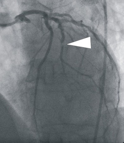 2008 03 05 17 02 43 706