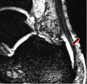 2008 03 10 00 05 30 706