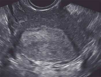 2008 03 11 16 22 32 706