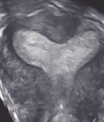 2008 03 11 16 22 48 706