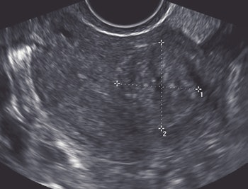 2008 03 11 16 23 06 706