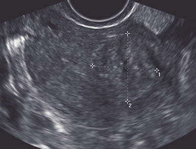 2008 03 11 16 23 06 706