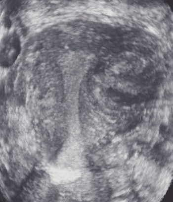 2008 03 11 16 23 21 706