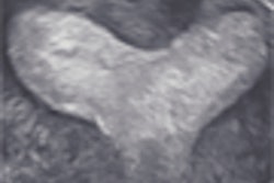 2008 03 11 16 23 42 706