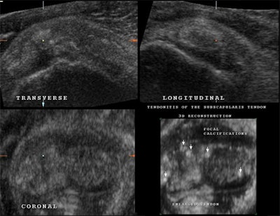 2008 03 16 20 38 58 706