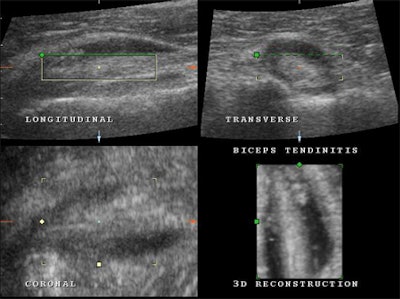 2008 03 16 20 39 42 706