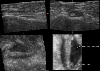 2008 03 16 21 25 46 706