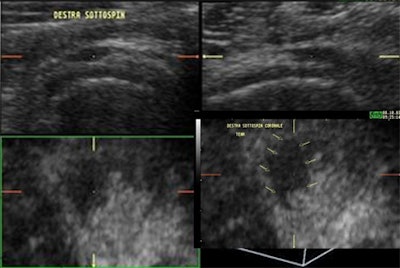 2008 03 16 22 11 57 706