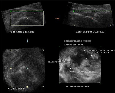 2008 03 16 22 12 29 706