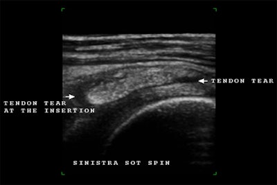 2008 03 16 22 12 42 706