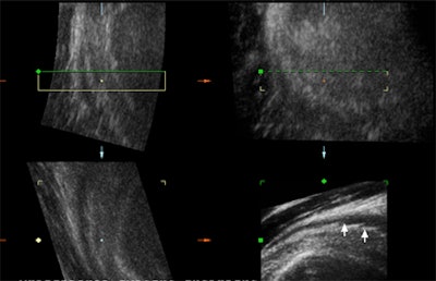 2008 03 16 22 13 08 706