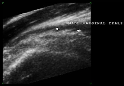 2008 03 16 22 13 22 706