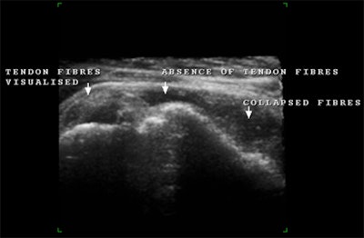 2008 03 16 22 13 34 706