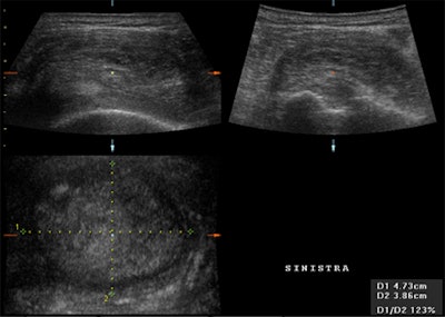 2008 03 16 22 14 36 706