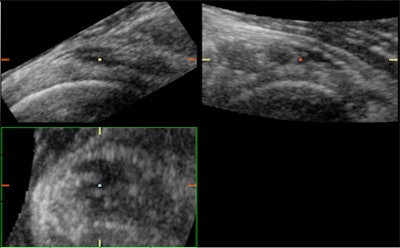 2008 03 16 22 25 57 706