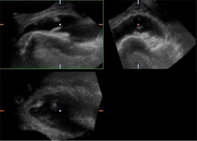 2008 03 16 22 28 58 706