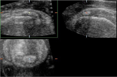 2008 03 16 22 30 53 706