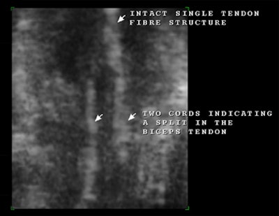 2008 03 16 22 40 06 706