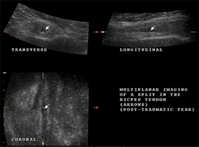 2008 03 16 22 42 12 706