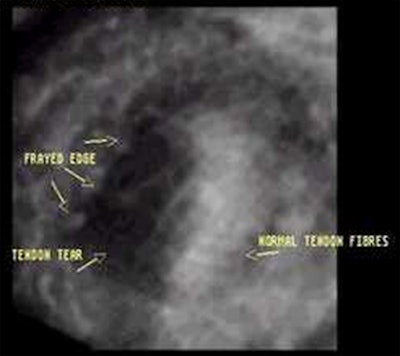 2008 03 16 22 46 18 706