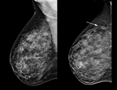 2008 03 25 14 16 49 706