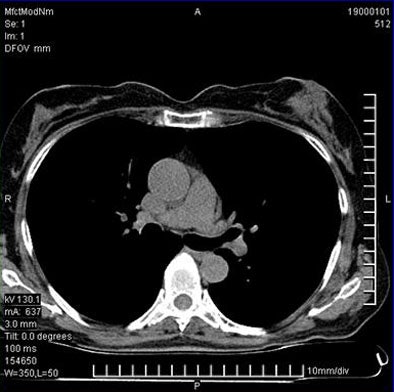 2008 03 31 13 50 16 706